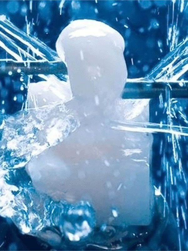 cerec