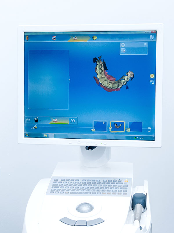 CAD CAM